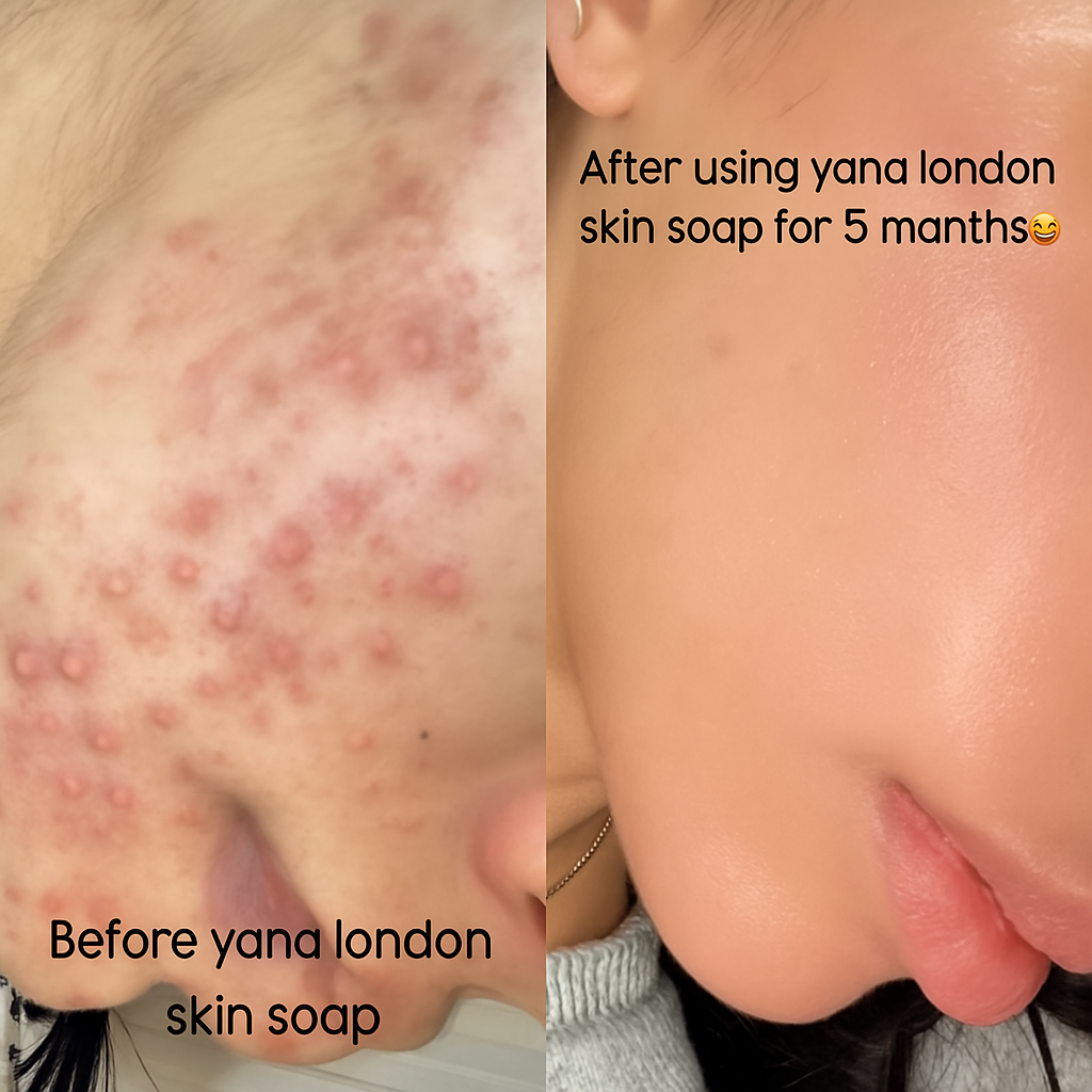 Yana London Kojic Acid Soap